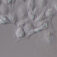 Transmitted-light_cells_DIC_Axiovert-5